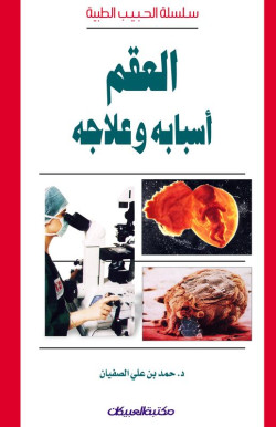 العقم أسبابه وعلاجه  